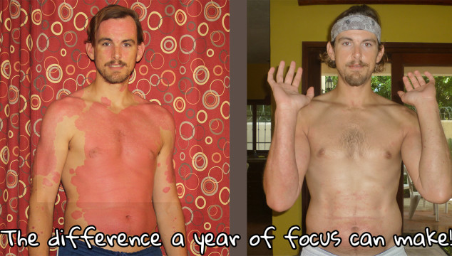 My Psoriasis Diet – ABCs & 123s Of Healing Naturally