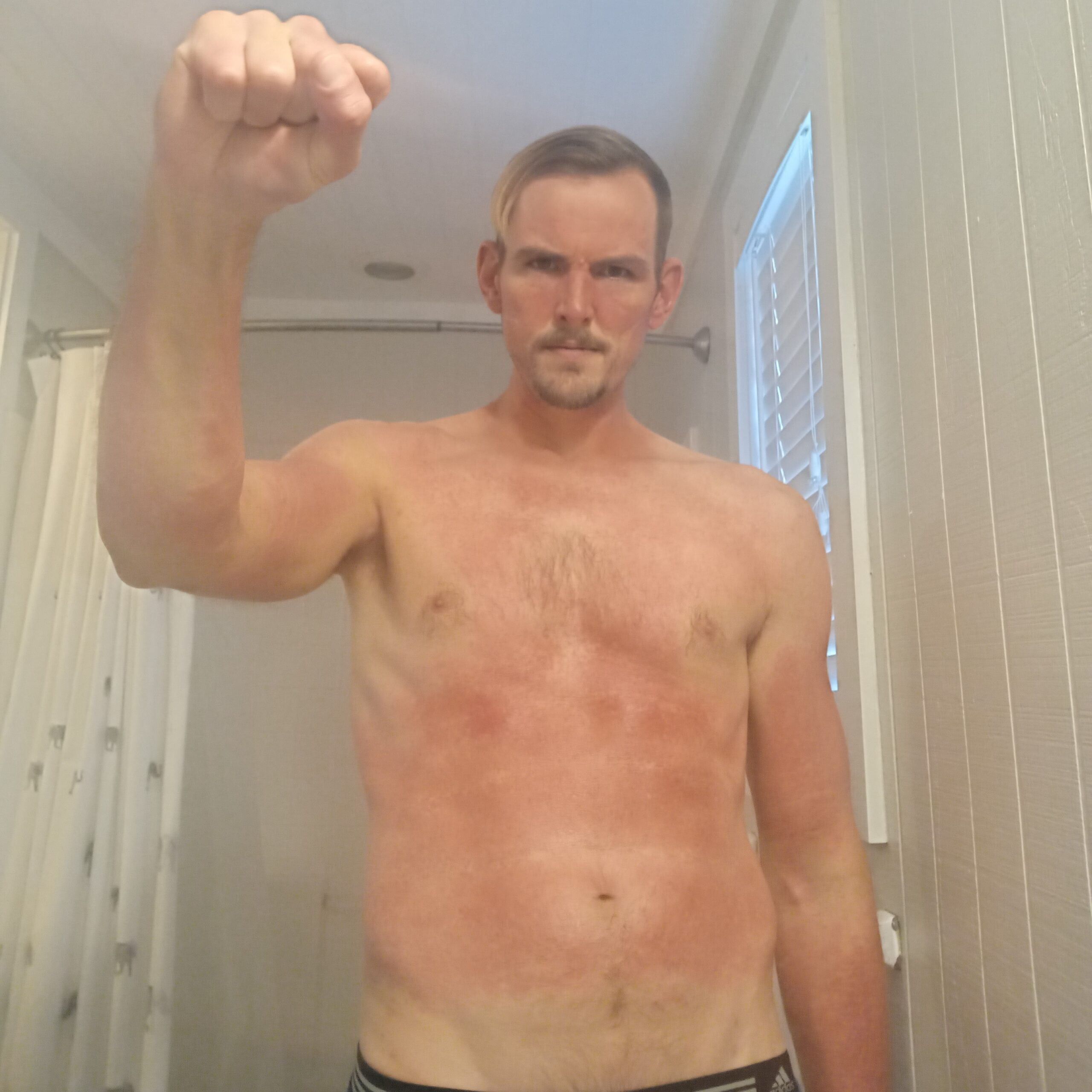 I’m grateful for psoriasis – My 7 gears of gratitude – A warrior who heals psoriasis naturally I’m grateful for psoriasis – My 7 gears of gratitude – A warrior who heals psoriasis naturally