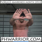 psoriasis awareness month 2022